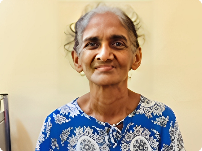 Sri Lanka Cancer Society - Stories Malini